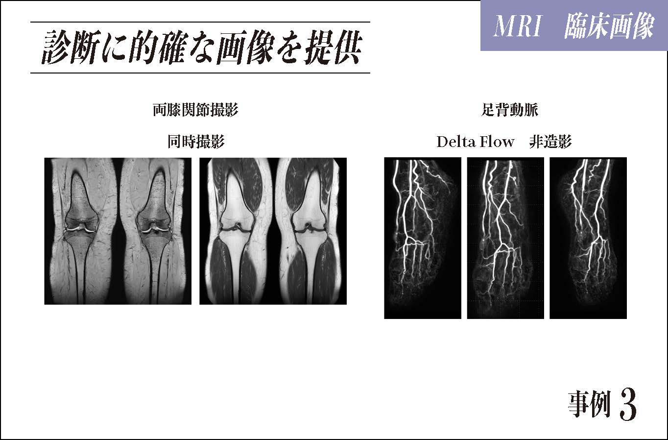 診断に的確な画像を提供 両膝関節撮影 足背動脈